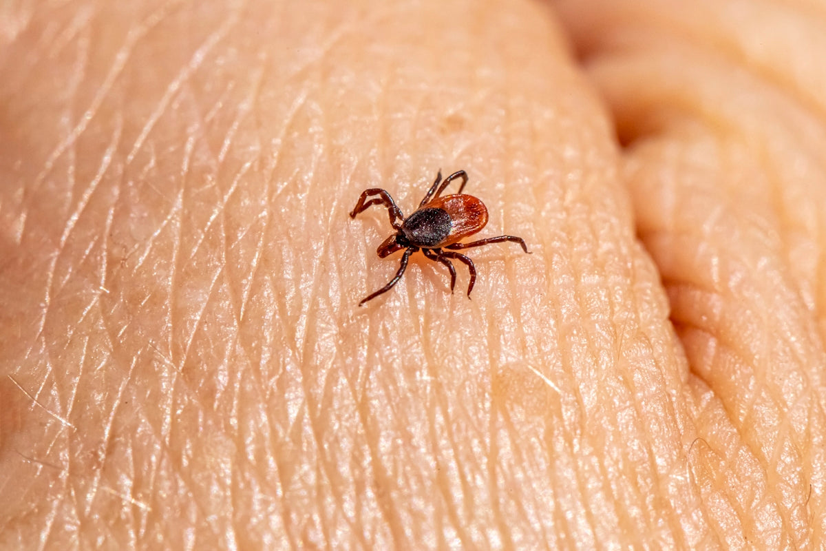 a tick sitting on the skin of someone's arm